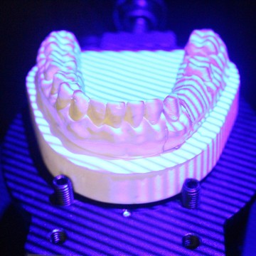 Dental autoscan portable 3d dental scanner for dental lab