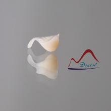 Mega Composite Resin Inlay