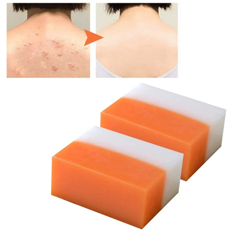 Natural Kojic Acid Whitening Deep Cleansing Cleanser Soap Bar