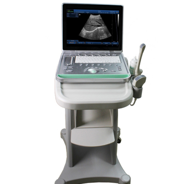 Digital Trolley Ultrasound Scanner