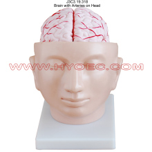 Brain with Arteries on Head-J3C3.19.318