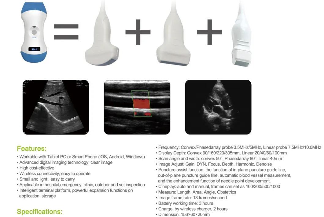 WiFi Probe /Type 3 in 1 Ultrasound Probe/ Wireless Mini Color Doppler Ultrasound