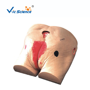 Decubitus Ulcer Care Teaching Model