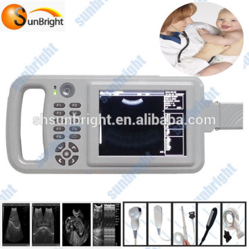 2d imaging ultrasound diagnostic equipment