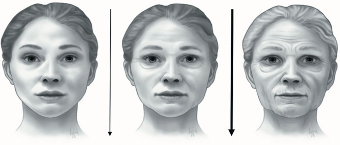 FACIAL ANATOMY