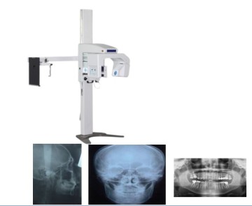 Panoramic Dental X-ray