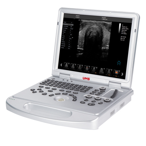 UW-L5 แล็ปท็อปสแกนเนอร์สี Doppler Ultrasound