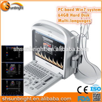 Portable Cardiology Color Doppler Ultrasound/Color Doppler