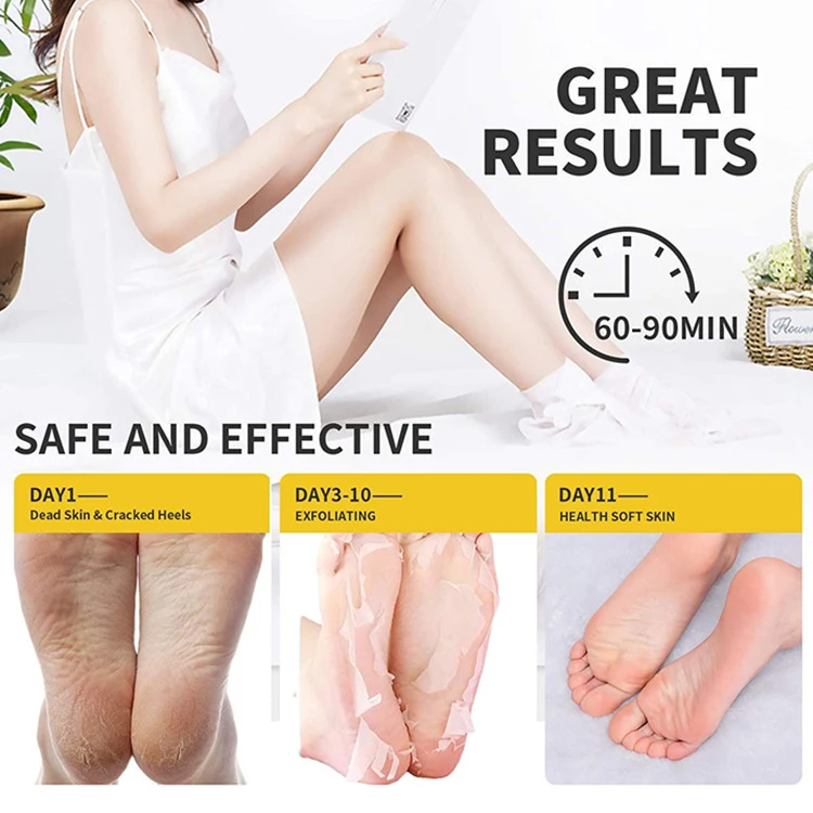 Custom Natural Honey Exfoliating Cracked Heels Repair Foot Peel Mask