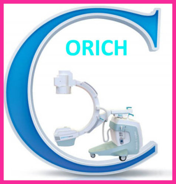 Mobile Fluoroscopic System -Portable C-Arm