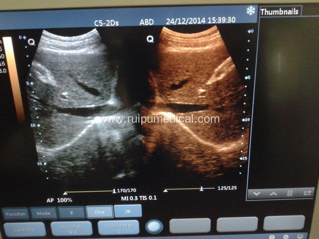 Portable Ultrasound Scanner Digital Ultrasound Machine Price