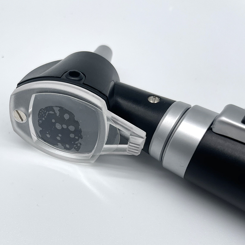 Portable Direct Illumination Otoscope for ear diagnostic