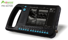 Digital Palmtop Diagnostic Ultrasounic System (PRO-BCP300)