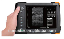 V5 Palm Ultrasound Scanner(ultrasonic,black white,Imaging System