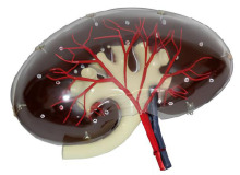 Transparent kidney model