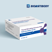 Thyroid Stimulating Hormone(TSH) Rapid Quantitative Test Kit