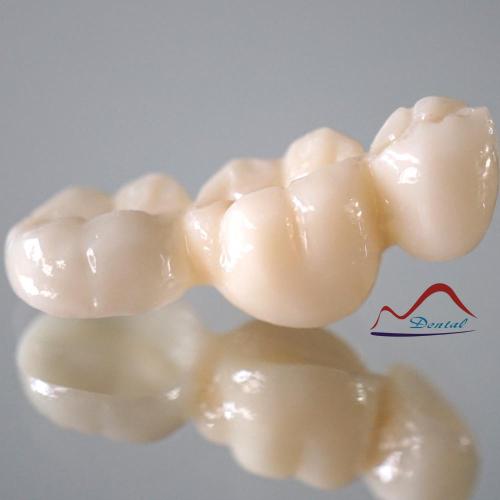 High Quality Full Contour Zirconia Bridge