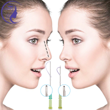 Facial Tensor Threads Pdo Thread Lifting Mono