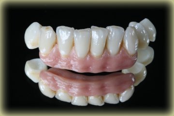 Ceramic Ips E.max With Dental Zirconia Inlay &amp; Onlay For Dental Esthetics