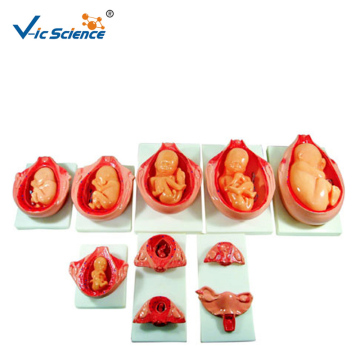 The Development Process For Fetus Model