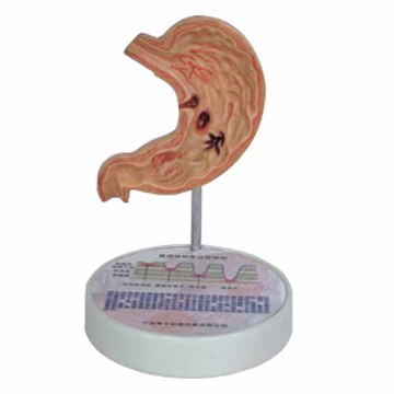 Human stomach model Medical stomach model