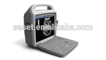 Clear Digital Ultrasonic Diagnostic Imaging System