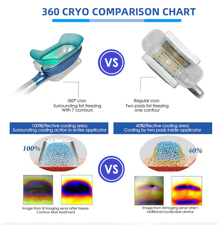 Frozen Fat Loss Device