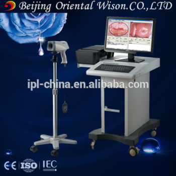 vertical equipment Gynecology examination medical colposcope medical equipment for hospital