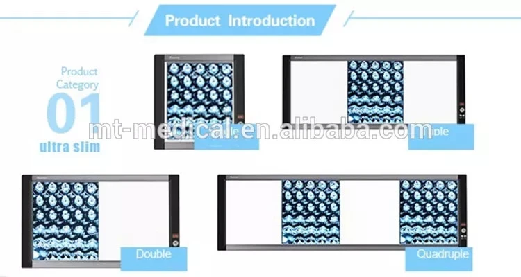 Medical LED X Ray Film Illuminator Film Viewer for Hospital