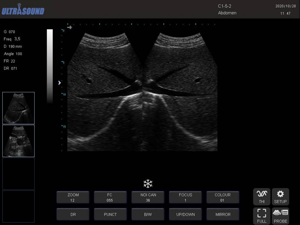 BB Печань 1 K7 Bb Liver 1 K7