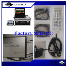 Intracranial Extracranial Blood Vessel Test transcranial doppler tcd equipment