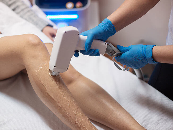 Diode Laser At Hair Removal Center