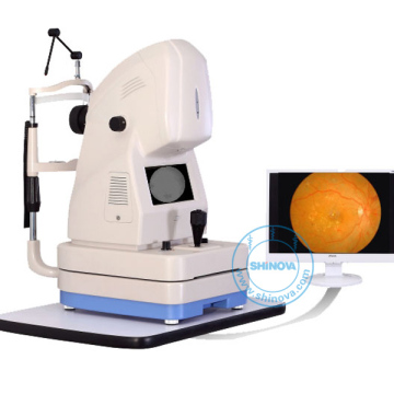 Digital Fundus Camera (FC-530)