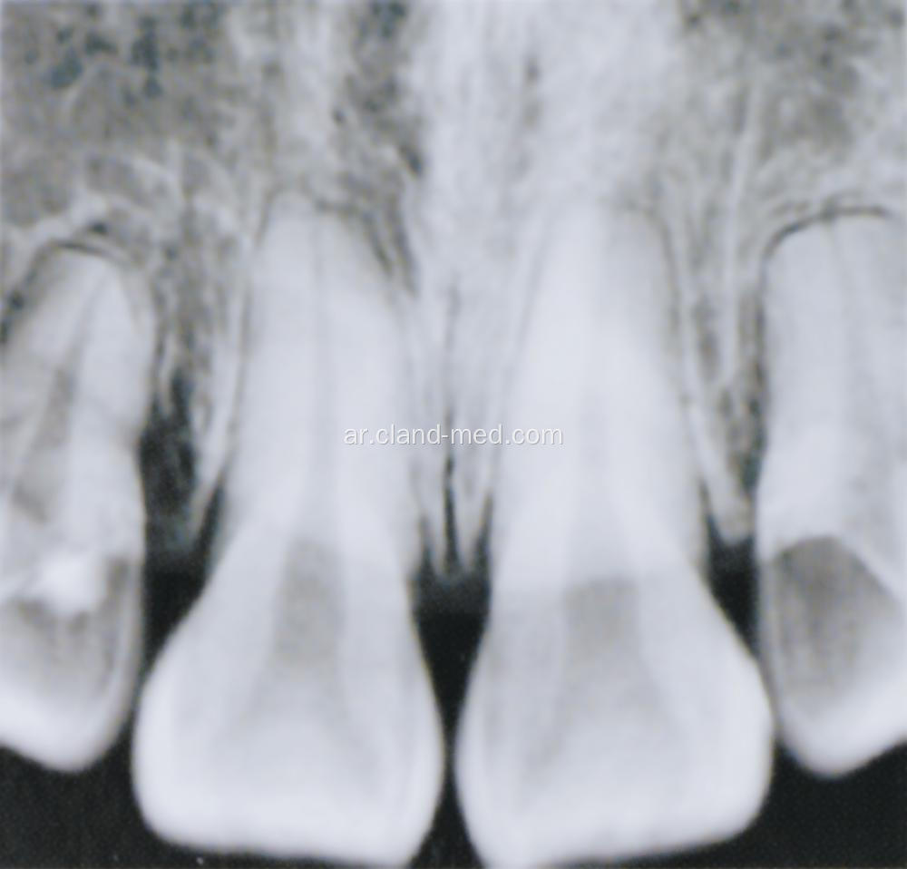 وحدة الأسنان X-RAY