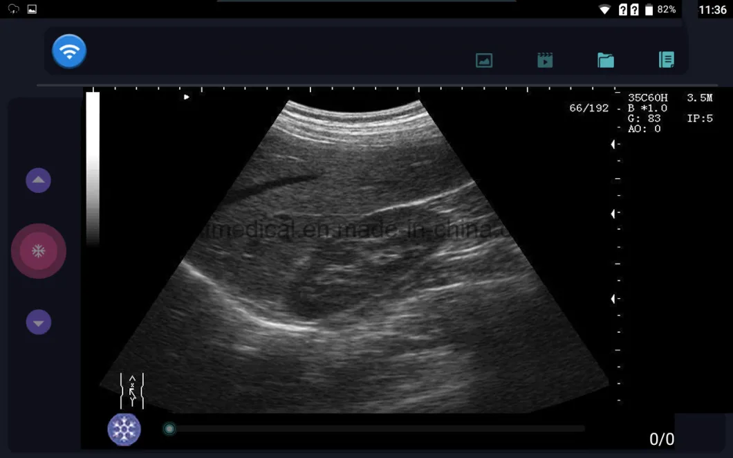 Probes Convex and Linear Portable Ultrasound Machine for Pregnancy / Medical Hospital Ultrasound Scanner