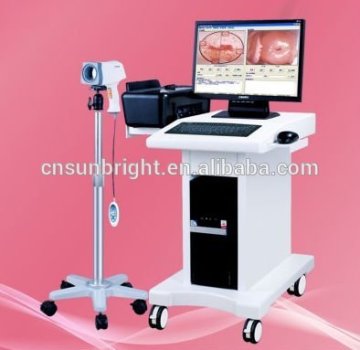 CE approved electronic camera colposcope with high resolution images