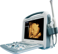 4D Volume Color Doppler Ob/Gyn