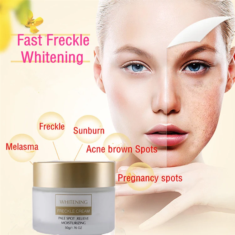 Powerful Whitening Freckle Cream Remove Melasma Acne Spots Pigment Melanin Dark Spots Face Care Cream