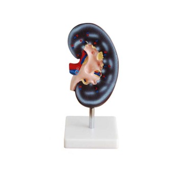 Medical Kidney Model 1 Part