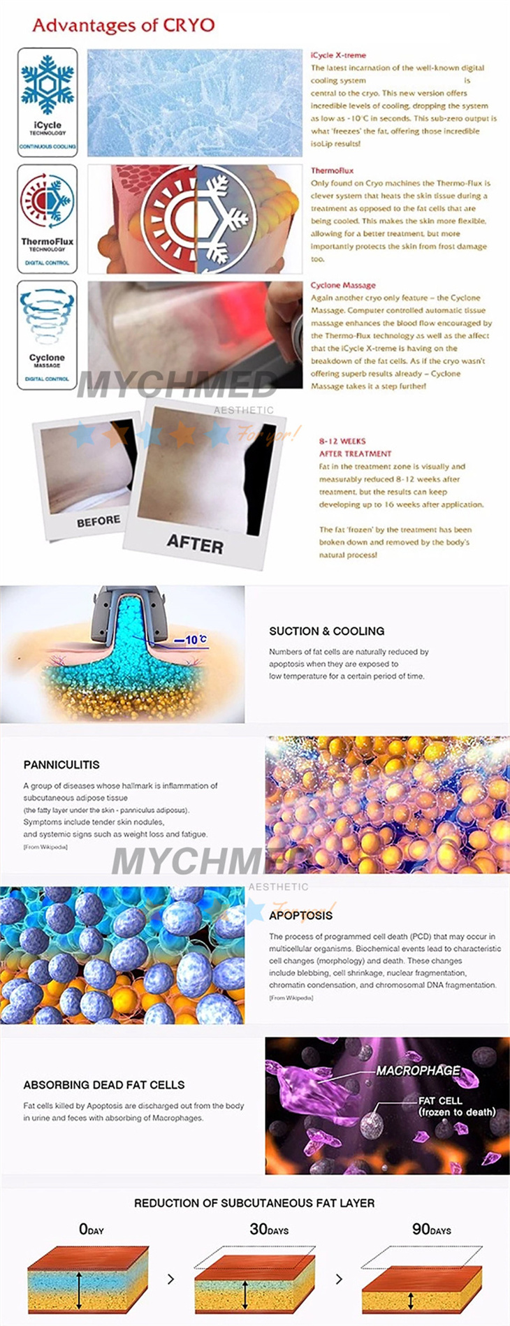 Cryo4 Cryo4