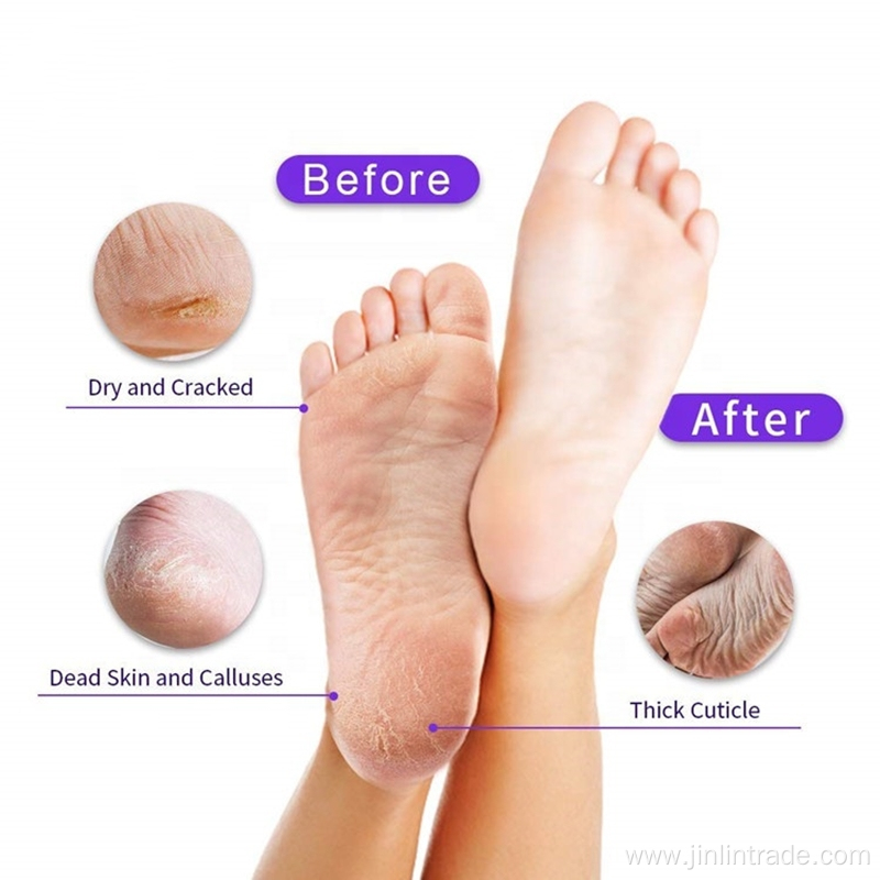 Remove Dead Skin Heels Foot Mask