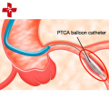 Intravasculaire PTCA-ballonkatheter