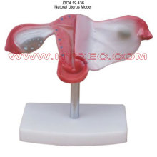 Natural Uterus Model-J3C4.19.436