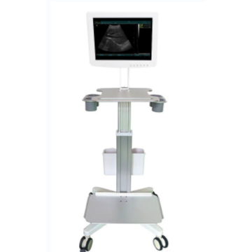 Machine de scanner à ultrasons 3D - écran tactile SS-100