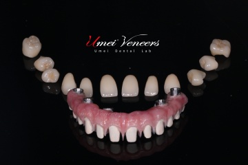 Biocompatible zirconia bridges