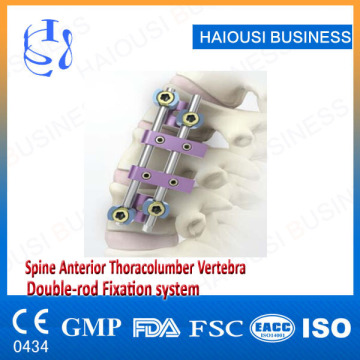 Anterior Spinal Thoracolumbar Fixation System