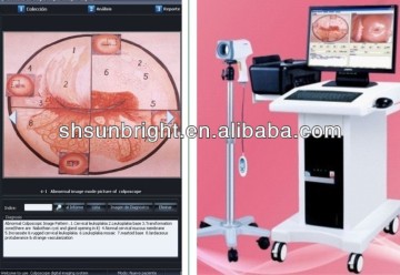 Digital Optical Colposcope