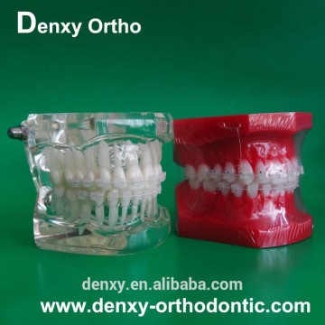 Dental model orthodontic model