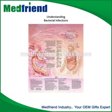 China Wholesale Custom Understanding Bacterial Infections Chart