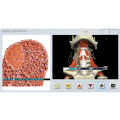 dispositif de diagnostic de l'aura non linéaire d'Oberon